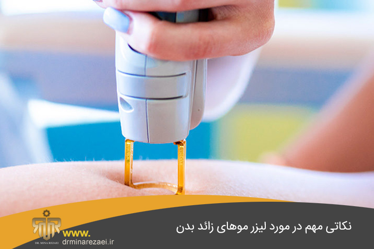 انواع لیزر موهای زائد