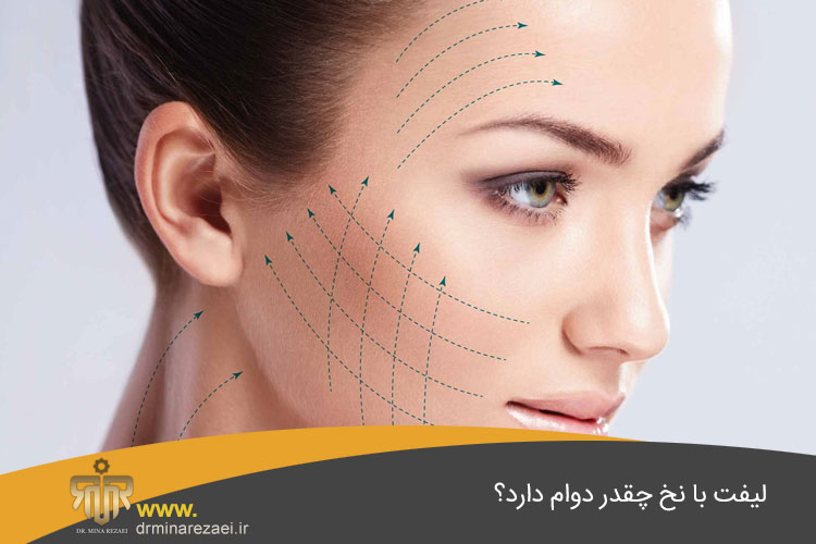 لیفت با نخ
