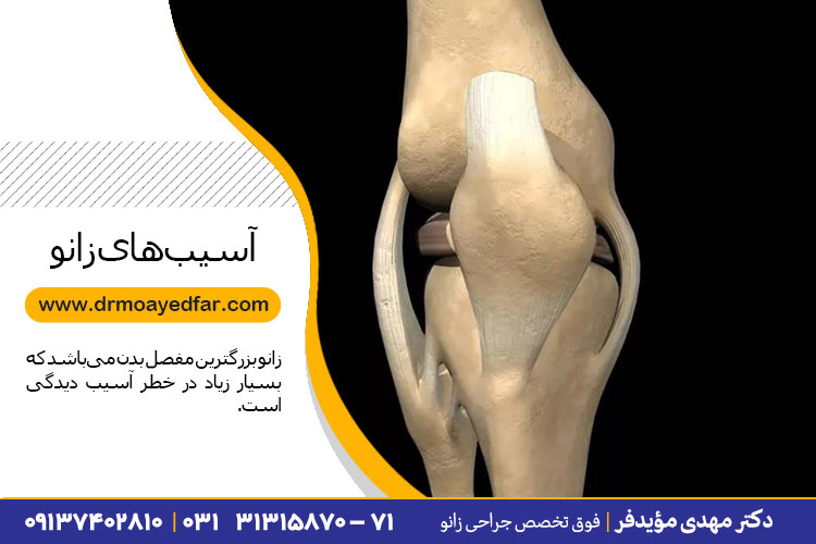 درمان آسیبهای زانو در اصفهان