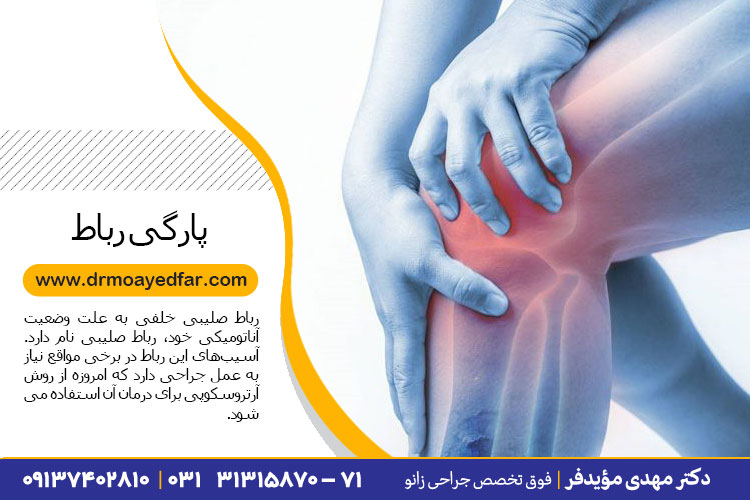 درمان پارگی رباط صلیبی در اصفهان