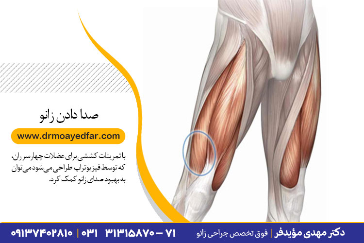 درمان صدا دادن زانو در اصفهان