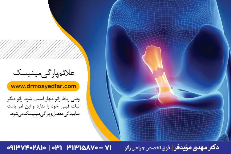 علائم پارگی مینیسک زانو