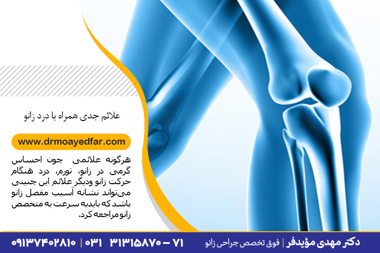 علائم جدی همراه با درد زانو