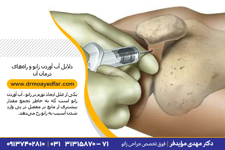 درمان آب آوردن زانو در اصفهان