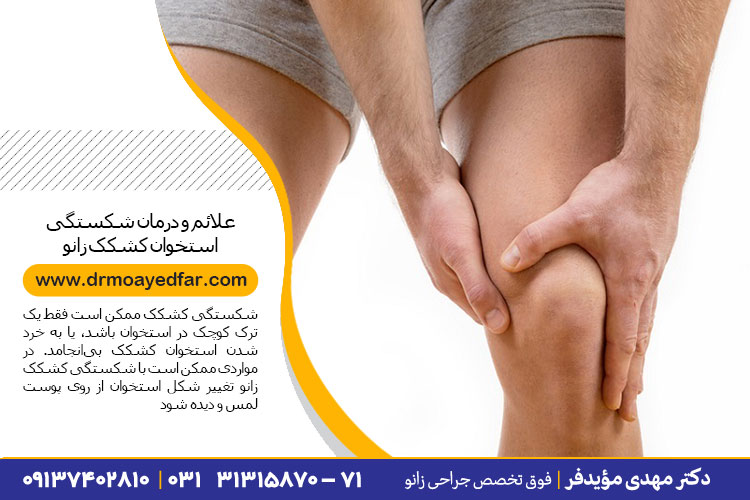 درمان شکستگی استخوان کشکک زانو
