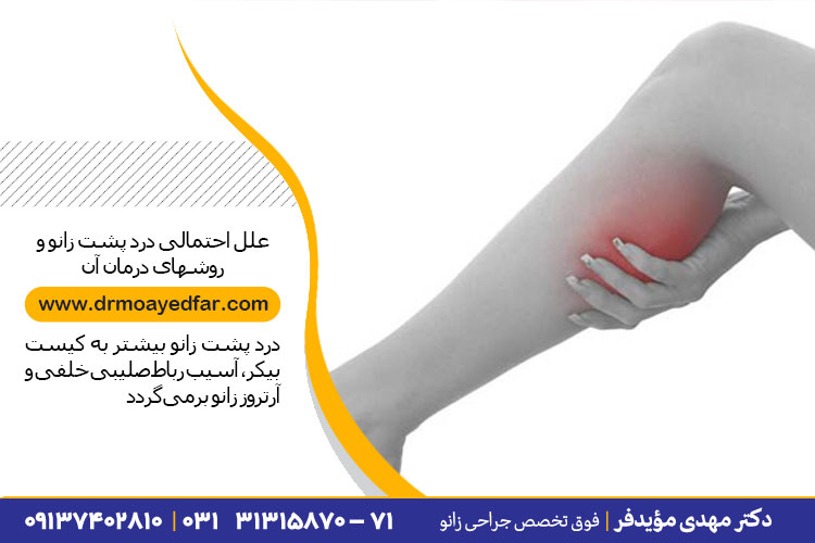 درد پشت زانو و درمان آن در اصفهان