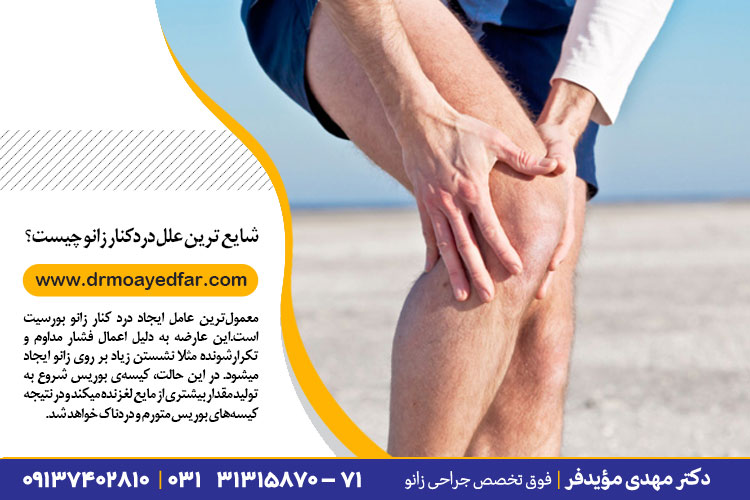 علت و درمان درد کنار زانو | درمان جراحی و غیر جراحی درد کنار زانو