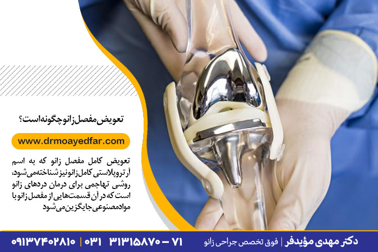 روش جراحی تعویض کامل مفصل زانو | جراح زانو