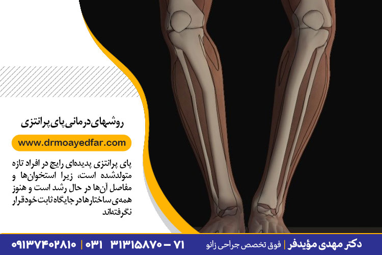 روشهای درمانی پای پرانتزی