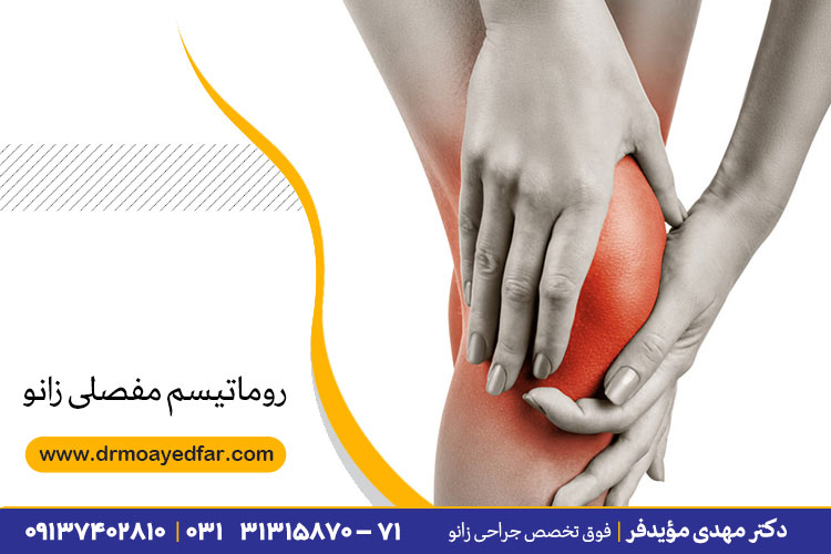 روماتیسم مفصلی زانو