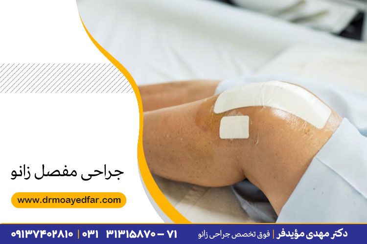 اقدامات قبل از جراحی زانو