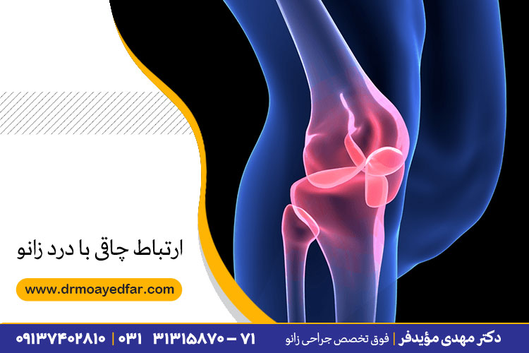 ارتباط چاقی با درد زانو
