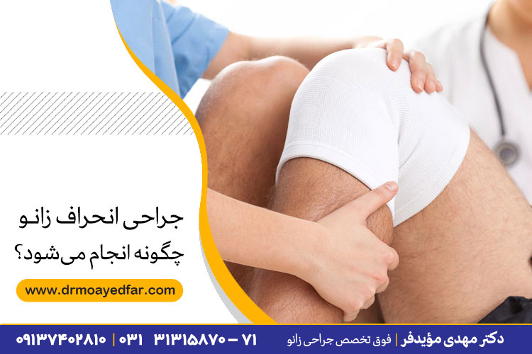 جراحی زانو