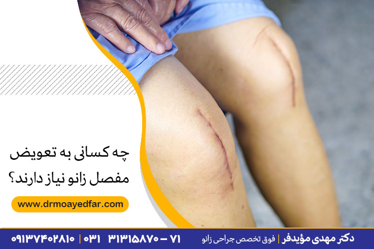 تعویض مفصل زانو