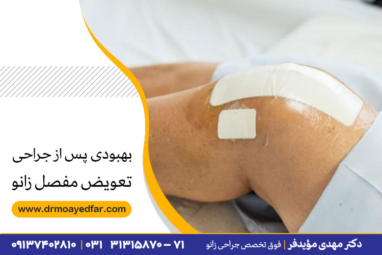 جراحی تعویض مفصل زانو