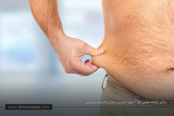 خطرات و عوارض جراحی لیپوساکشن