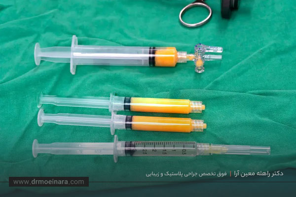 تزریق چربی هیپ دیپ