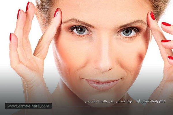 انواع روش های لیفت شقیقه