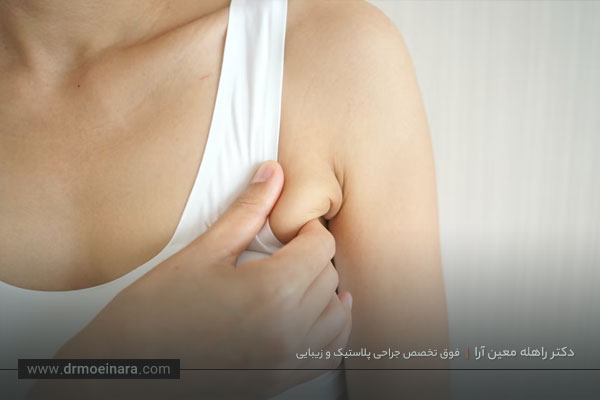 لیفت لترال قفسه سینه 