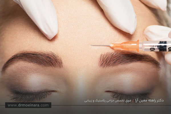 بوتاکس خط اخم 