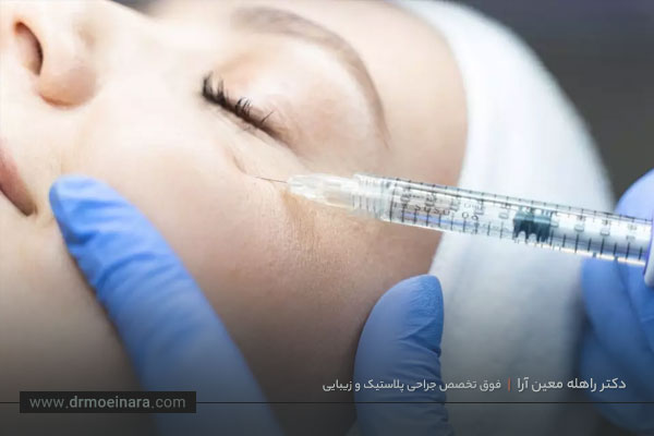 تزریق فیلر زیر چشم
