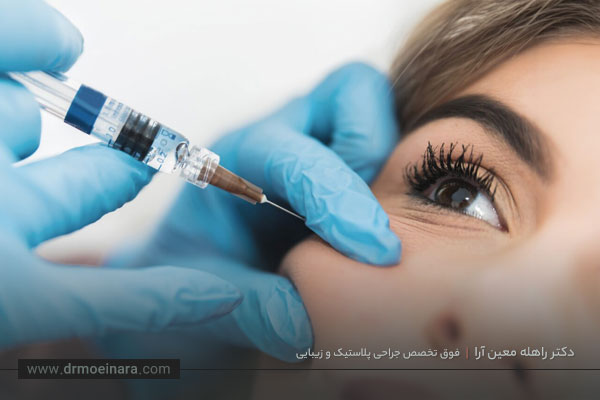 تزریق فیلر گونه 