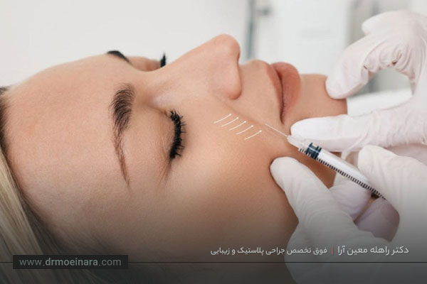 فیلر خط خنده 