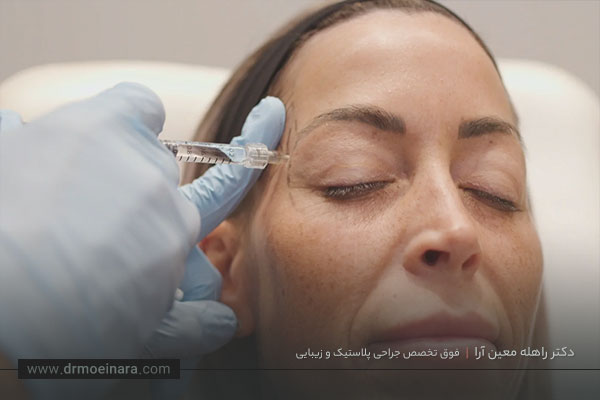فیلر شقیقه