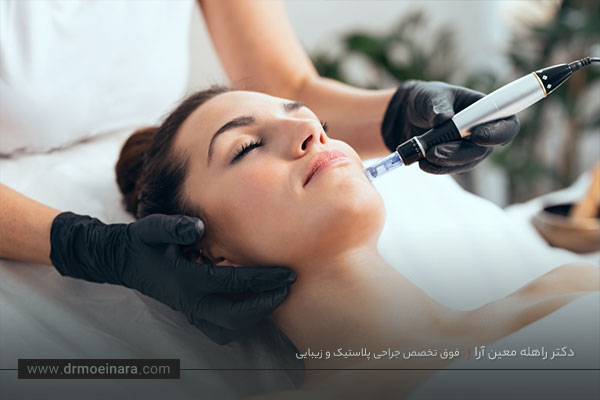 مزوتراپی صورت