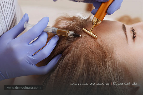 مزوتراپی مو