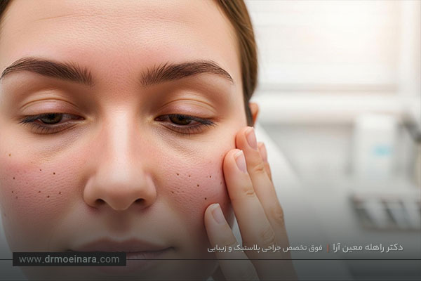 عوارض مزوتراپی