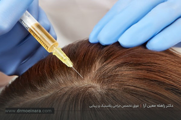 پی آر پی مو چیست