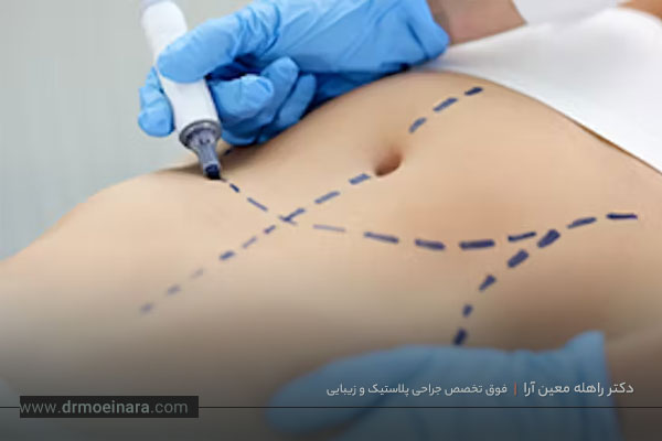 تفاوت ابدو و مینی ابدو 