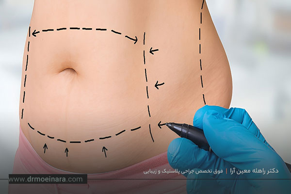 تفاوت ابدو و مینی ابدو چیست 