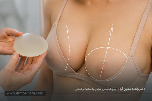 هزینه عمل لیفت سینه همراه با پروتز