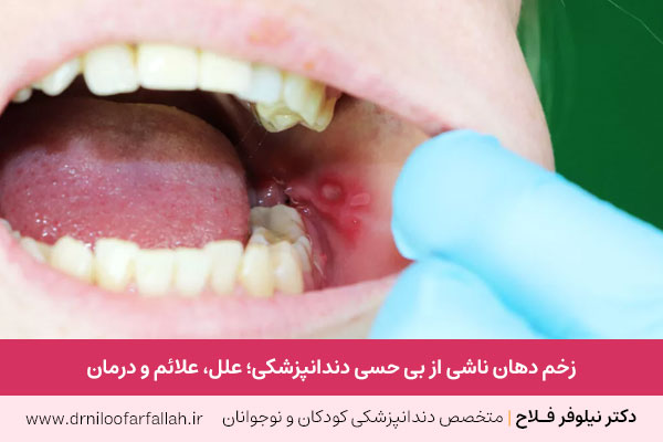 زخم دهان ناشی از بی حسی دندانپزشکی 