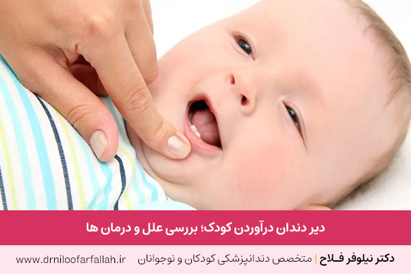 دیر دندان درآوردن کودکان