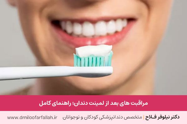 مراقبت های بعد از لمینت دندان 