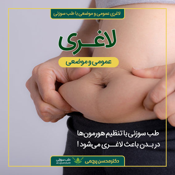 لاغری موضعی و عمومی با طب سوزنی دکتر محسن پرچمی بهترین متخصص طب سوزنی ایران