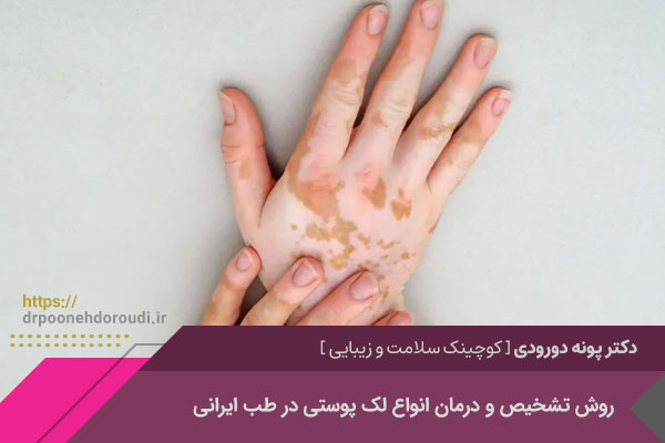 درمان لک پوستی اصفهان