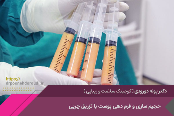 تزریق چربی در اصفهان