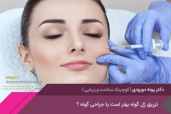 تزریق ژل گونه در اصفهان