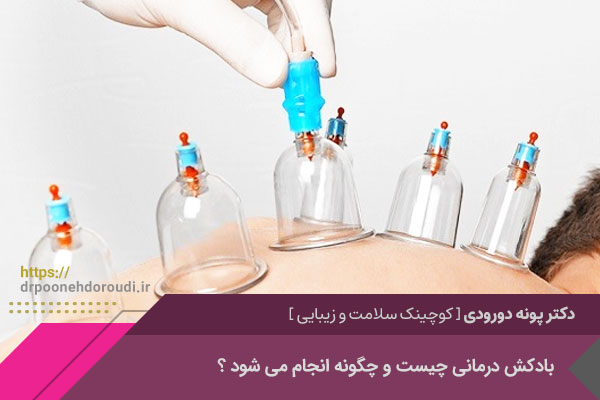 بهترین بادکش درمانی در اصفهان