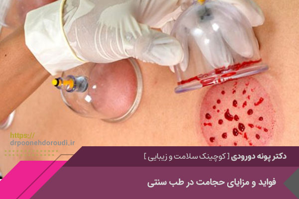 بهترین حجامت در اصفهان