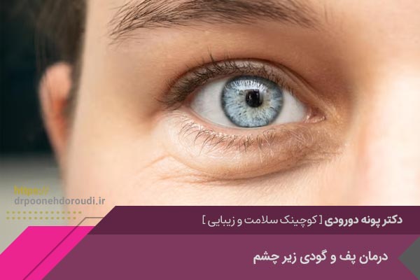 درمان پف و گودی زیر چشم در اصفهان