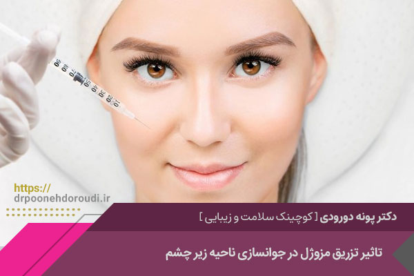 تاثیر تزریق مزوژل در جوانسازی 