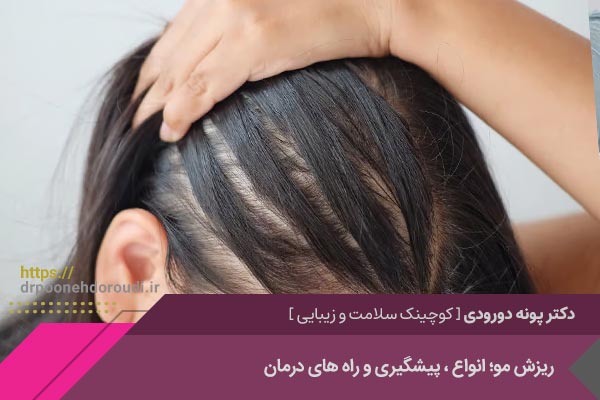 ریزش مو و روش های درمان آن