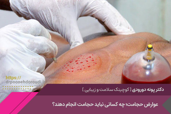 عوارض حجامت