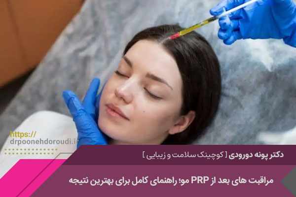 مراقبت های بعد از پی آر پی مو 
