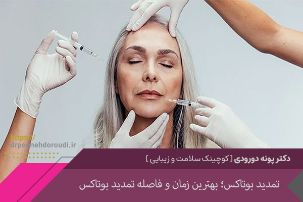 تمدید بوتاکس